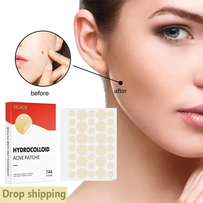 Before & After Results with ECLIOC 144 Hydrocolloid Acne Patches