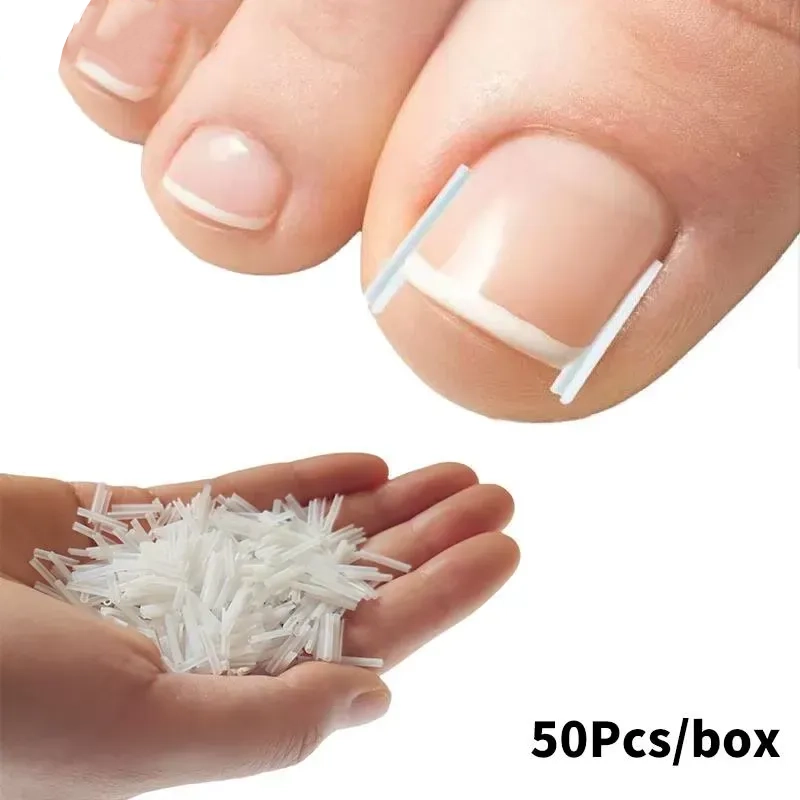 Professional Ingrown Toenail Correction Strips – White Lifters Placed Under Curved Nails for Gentle Relief (50 Pcs/Box).
