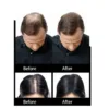 Before & after using Hair Fibers Refill Bag for bald spots