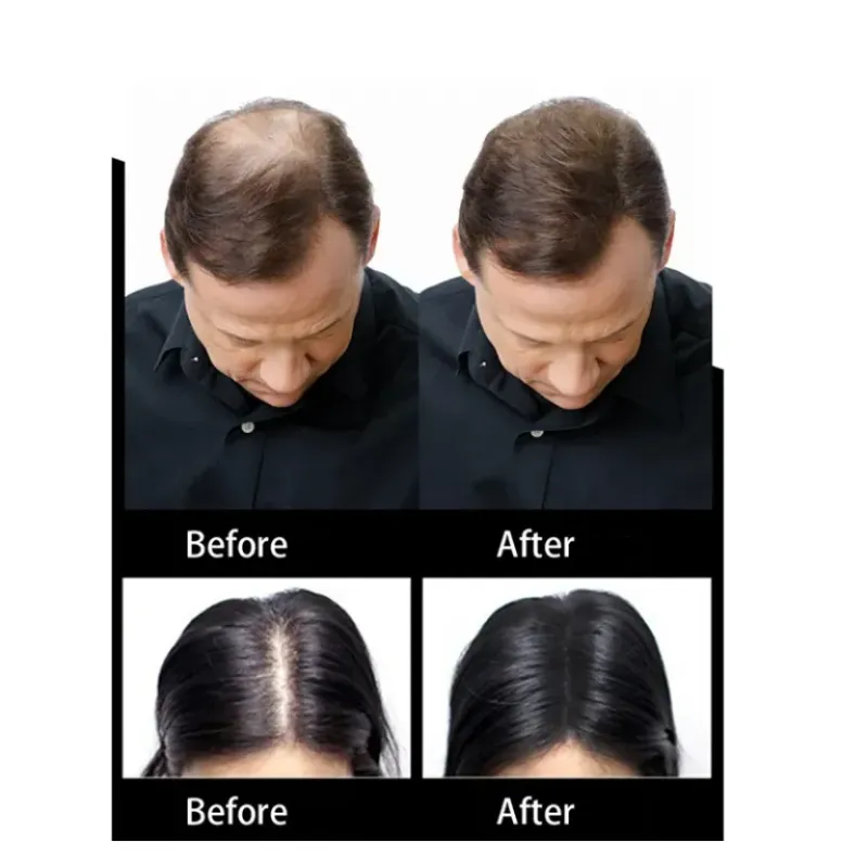 Before & after using Hair Fibers Refill Bag for bald spots